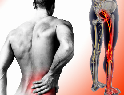 https://ls-holistics.co.uk/wp-content/uploads/2019/02/sciatica-low-back.png